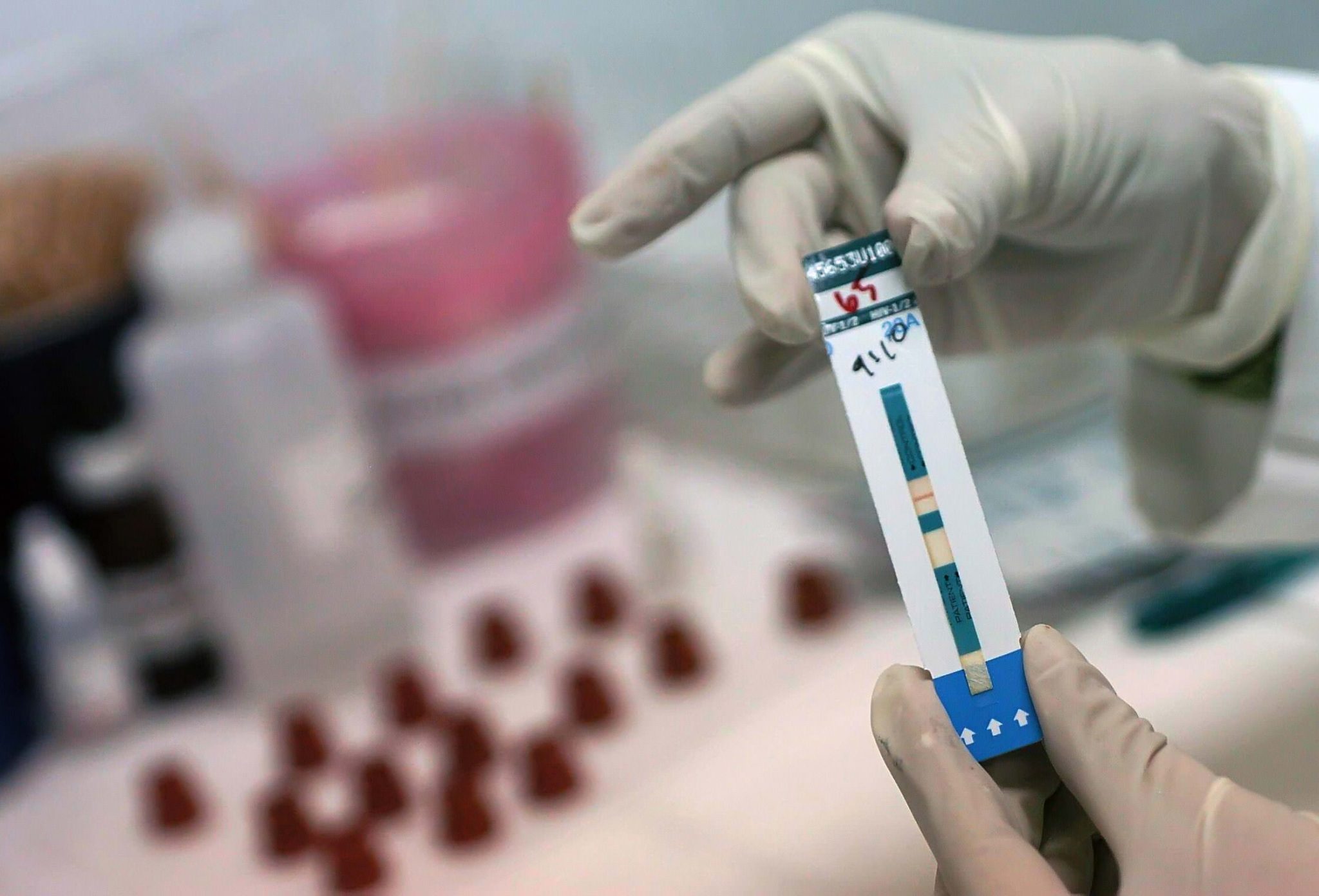 Chile: Instituto de Salud Pública advierte incremento de casos de VIH/Sida en el país